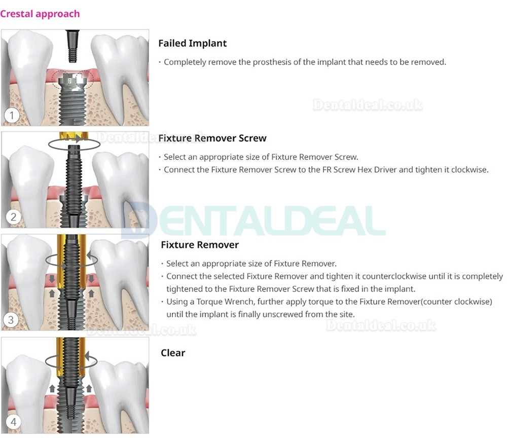 Dental Implant Fixture Removal Set with Remover Screw, Torque Wrench and Ratchet